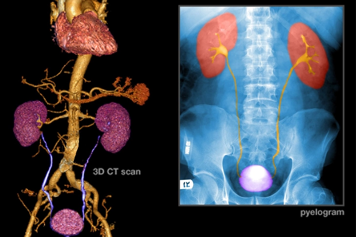 Diagnosis: Imaging Diagnosis: Imaging
