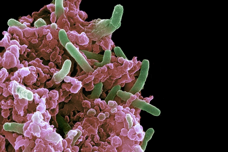 Treatment: Immunotherapy Treatment: Immunotherapy