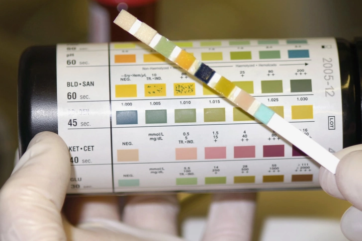 Warning Sign: Blood in Urine Warning Sign: Blood in Urine
