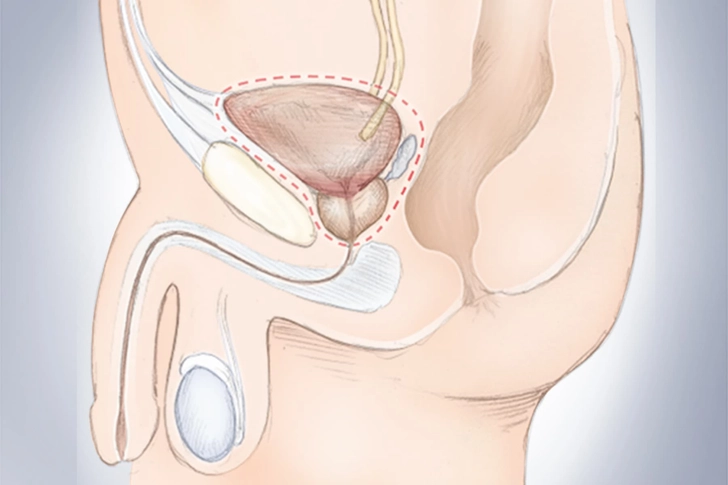 Treatment: Surgery Treatment: Surgery