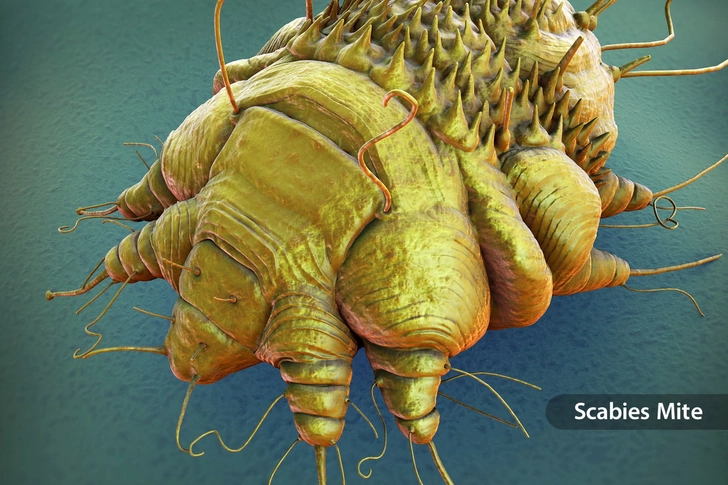 Bug Bites