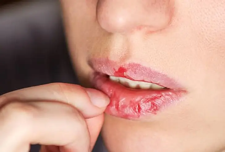 More Than a Bad Habit More Than a Bad Habit
