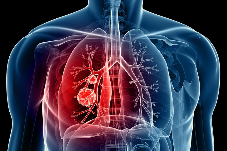 Lungs
