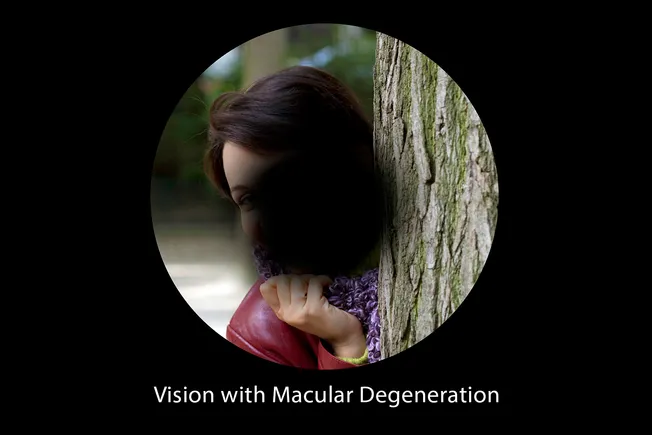 photo of macular degeneration simulation