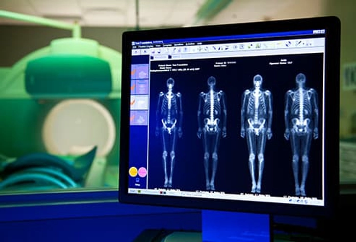 Diagnosis: Imaging Tests