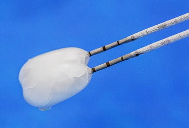 Treatment: Cryosurgery