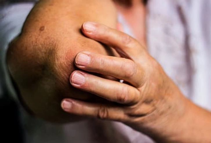 Symptom: Pain