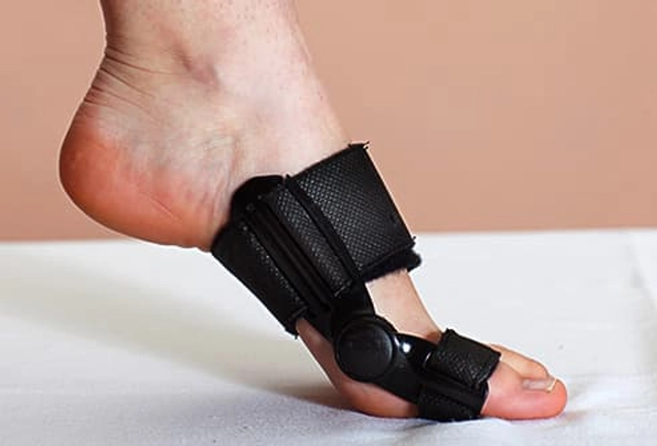 Bunions Bunions