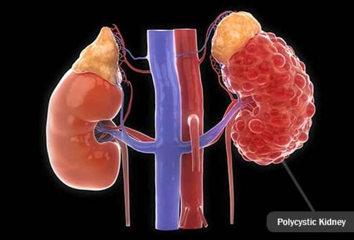 Risk Factors: Health Conditions and Lifestyle