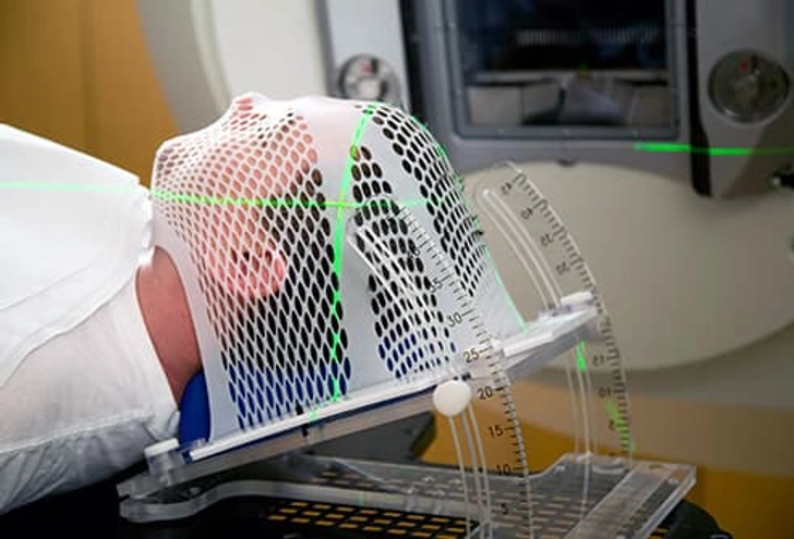Treatment: Radiation Therapy