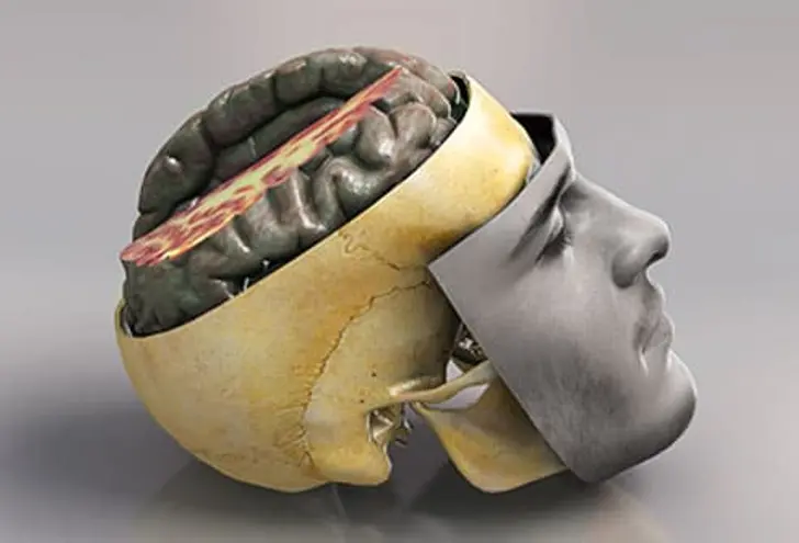 Head Injuries and Your Brain