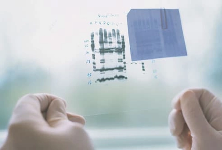Breast Cancer Genes