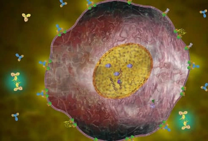 HER2-Positive Breast Cancer HER2-Positive Breast Cancer