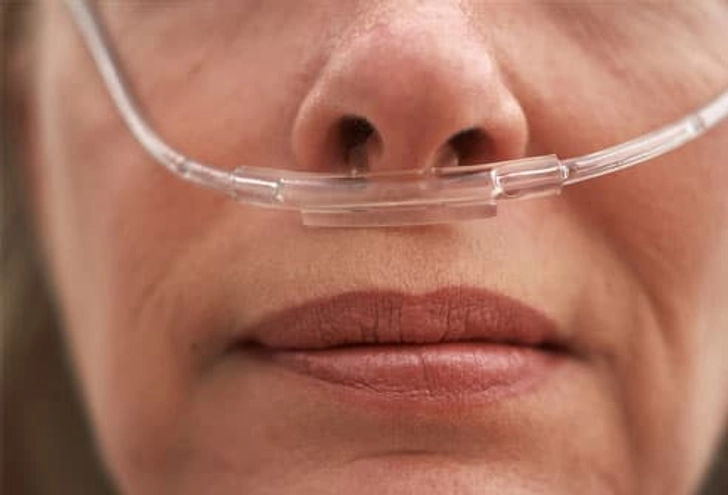 Chronic Bronchitis and COPD Chronic Bronchitis and COPD