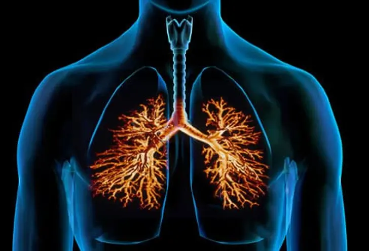 What is Bronchitis? What is Bronchitis?