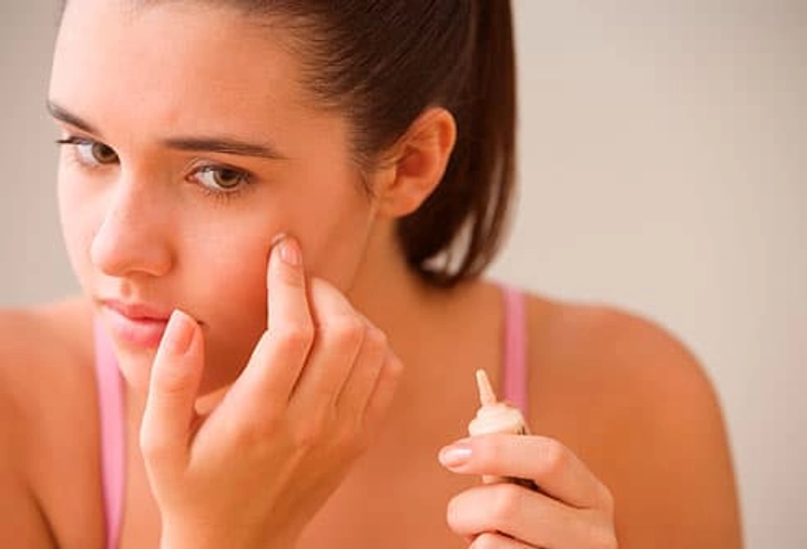 Hiding Blemishes Hiding Blemishes