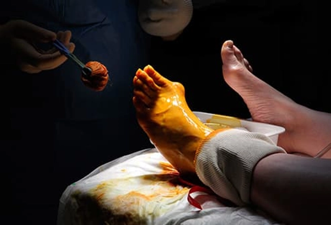 Treatment: Surgery Treatment: Surgery