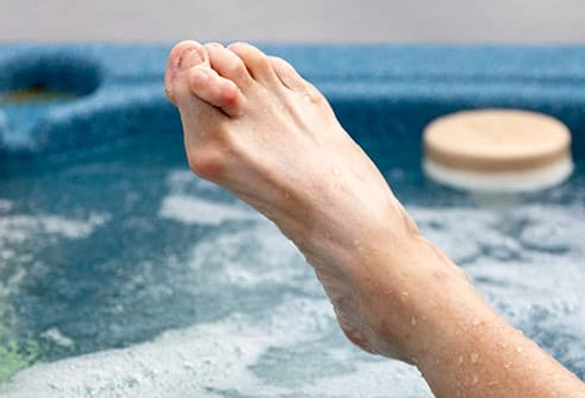 Complication: Hammertoe Complication: Hammertoe