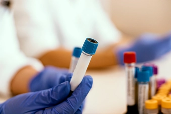 Does My Partner Need to Get Tested? Does My Partner Need to Get Tested?