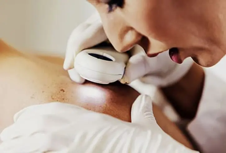 Changes in Your Skin Changes in Your Skin