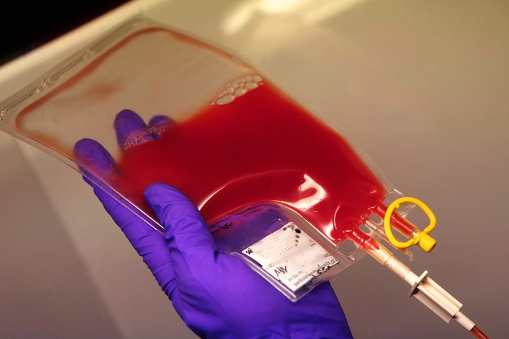Stem Cell Transplant