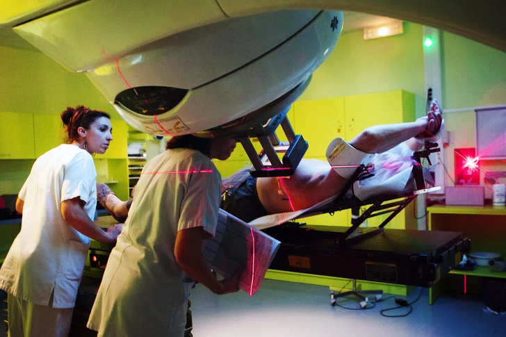 External Beam Radiation