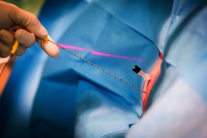 Other Surgeries