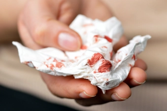 Watch Out for Bleeding