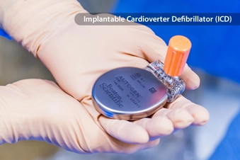 If You Need an ICD