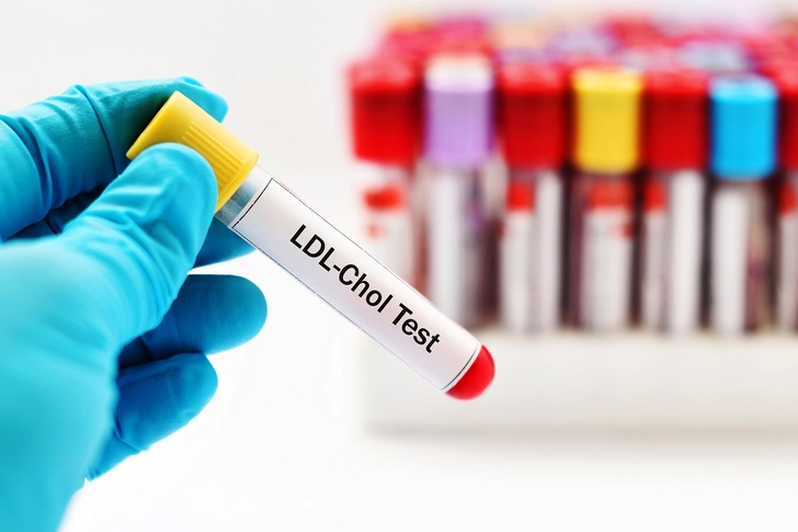 Improve Your Cholesterol
