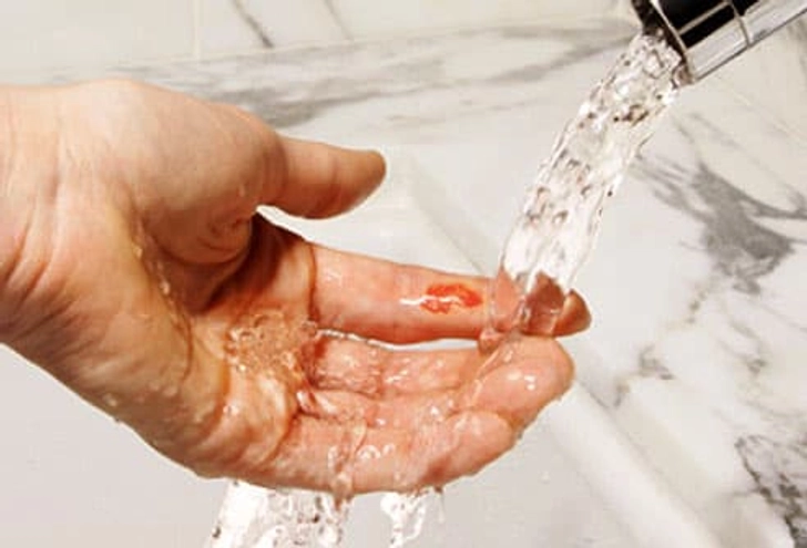 Clean Cuts and Scrapes Gently