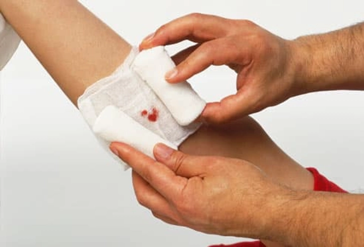 Signs of Adhesive or Latex Allergy