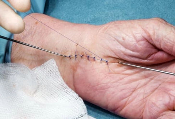 What to Expect After Surgery