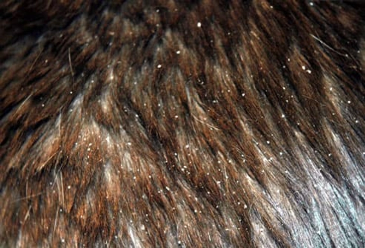 Dry, Flaky Skin Dry, Flaky Skin