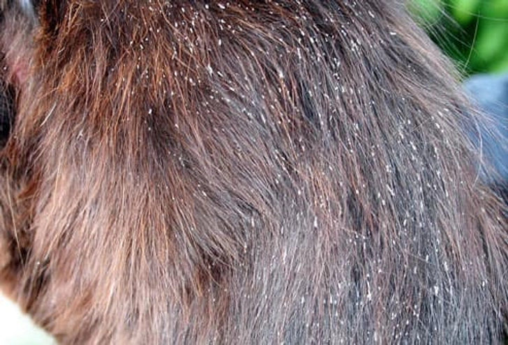 Lice