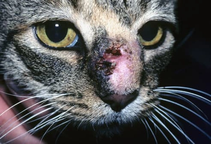 Sporotrichosis Sporotrichosis