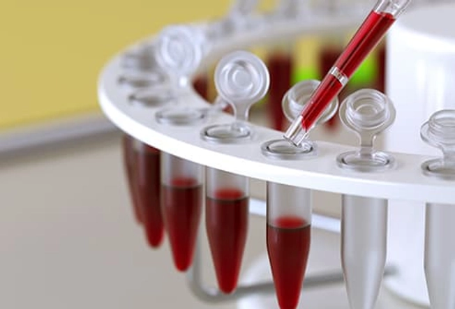 Diagnosis: Blood Tests