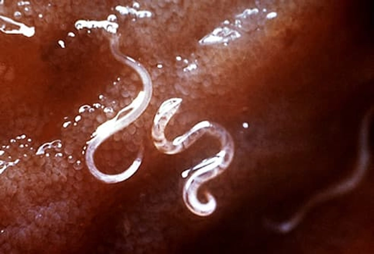 Celiac Disease Research