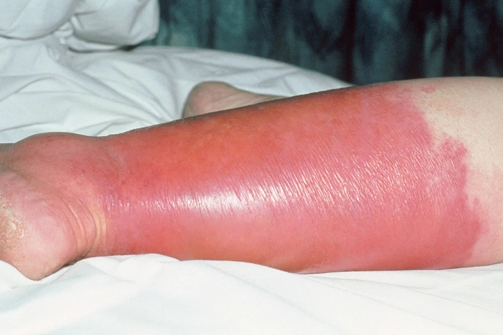Watch for These Symptoms