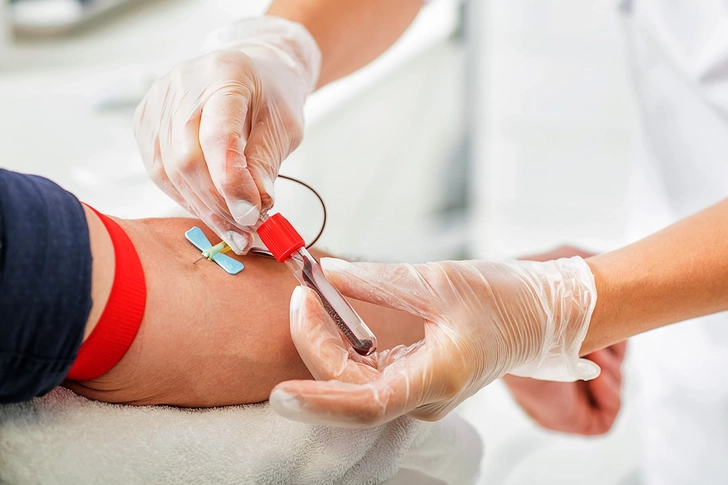 Lab Tests for Cellulitis
