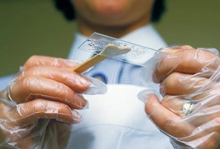 Cervical Cancer Screening Cervical Cancer Screening
