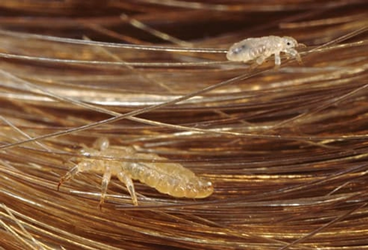Lice