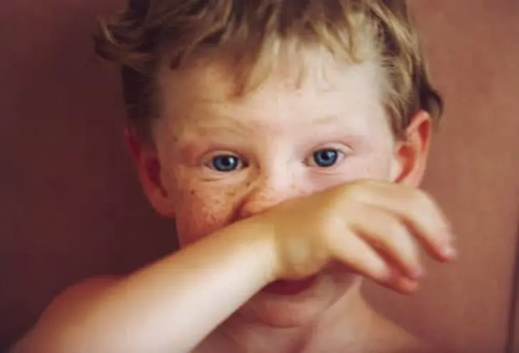 Childhood Illnesses: The Facts Childhood Illnesses: The Facts