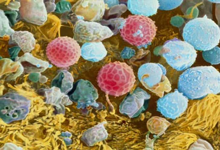 Seasonal Allergies