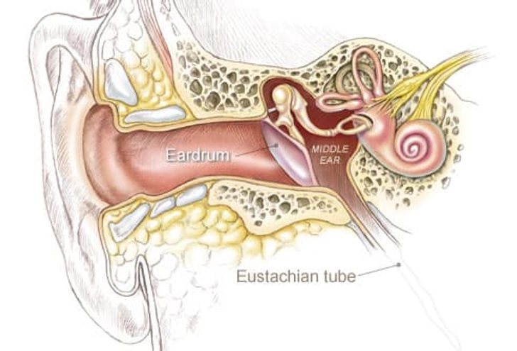 Ear Infection Ear Infection