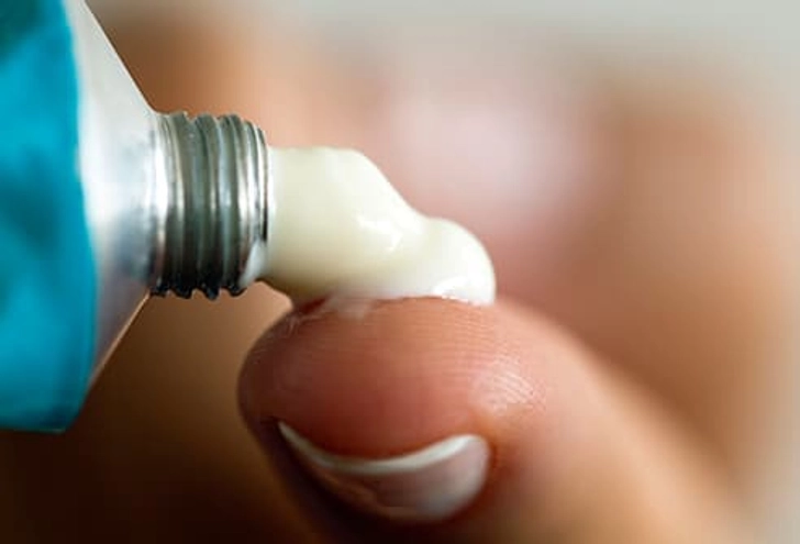 Do: Try Steroid Cream