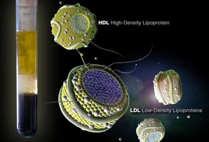 Cholesterol Testing