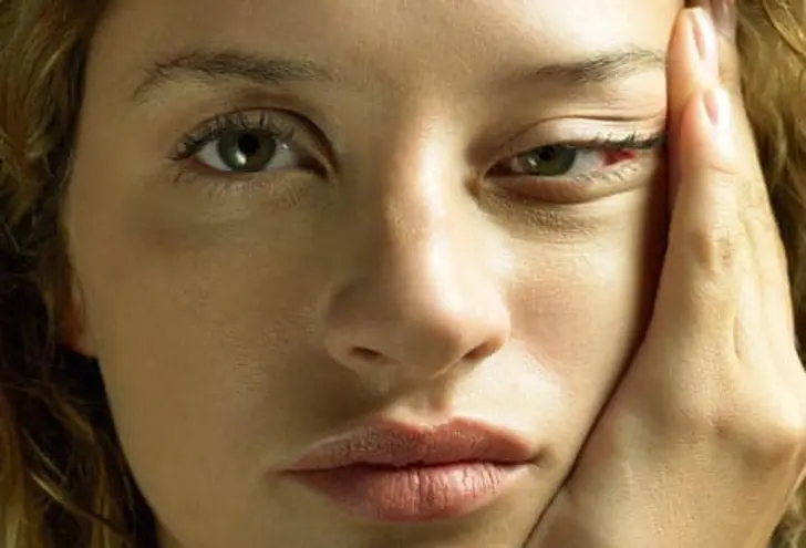 What Is Myalgic Encephalomyelitis/Chronic Fatigue Syndrome (ME/CFS)?