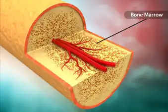 What Is CLL?