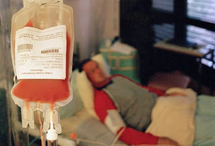 Stem Cell Transplant